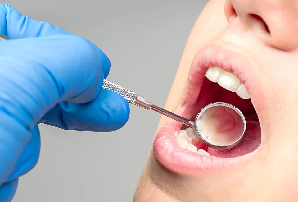 Dentist Supports